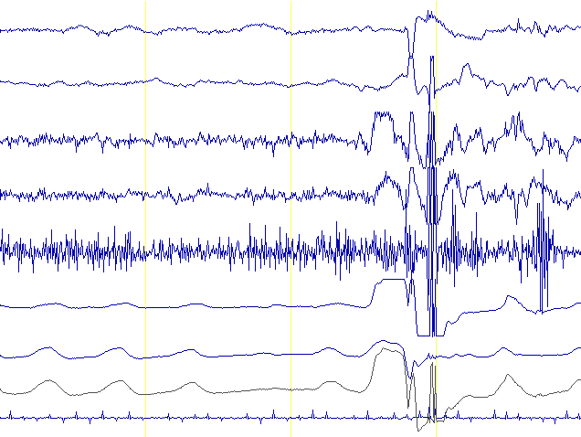 EEG signals